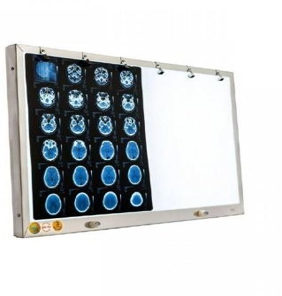 Đèn đọc phim X-quang DDF